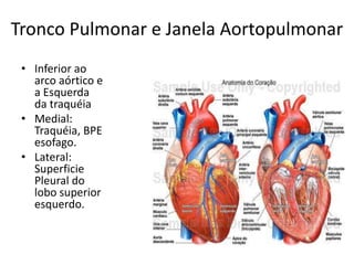 Tronco Pulmonar e Janela Aortopulmonar
 • Inferior ao
   arco aórtico e
   a Esquerda
   da traquéia
 • Medial:
   Traquéia, BPE
   esofago.
 • Lateral:
   Superficie
   Pleural do
   lobo superior
   esquerdo.
 