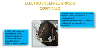 Proporciona una imagen de la actividad
bioléctrica de las neuronas en la
corteza cerebral.
Se generan potenciales en la superficie
cerebral que son captados por
electrodos.
El EEGC está indicado en
pacientes con crisis
convulsivas, para ver
actividad convulsiva,
descartar estatus
epilépticos no convulsivos.
 