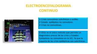 ELECTROENCEFALOGRAMA
CONTINUO
Crisis convulsivas subclínicas o sutiles.
Estado epiléptico no convulsivo.
Crisis no convulsivas.
El EEGc es el único método que permite un
diagnóstico precoz de las crisis y Estados
Epilépticos no convulsivo en la UCI. Ya que la
mayoría de las crisis epilépticas son subclínicas.
 