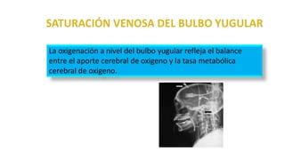 La oxigenación a nivel del bulbo yugular refleja el balance
entre el aporte cerebral de oxigeno y la tasa metabólica
cerebral de oxigeno.
 