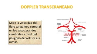 Mide la velocidad del
flujo sanguíneo cerebral
en los vasos grandes
cerebrales a nivel del
polígono de Willis y sus
ramas.
DOPPLER TRANSCRANEANO
 
