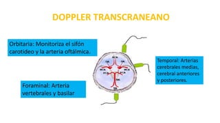 Temporal: Arterias
cerebrales medias,
cerebral anteriores
y posteriores.
Foraminal: Arteria
vertebrales y basilar
Orbitaria: Monitoriza el sifón
carotideo y la arteria oftálmica.
DOPPLER TRANSCRANEANO
 