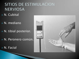    N. Cubital

   N. mediano

   N. tibial posterior.

   N. Peronero común.

   N. Facial
 
