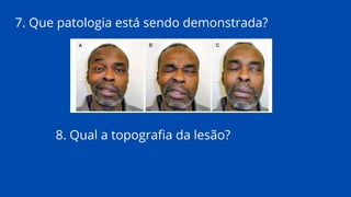 7. Que patologia está sendo demonstrada?
8. Qual a topografia da lesão?
 