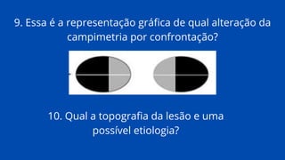 9. Essa é a representação gráfica de qual alteração da
campimetria por confrontação?
10. Qual a topografia da lesão e uma
possível etiologia?
 