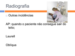 Radiografia
   Outras incidências

AP: quando o paciente não consegue sair do
 leito;

Laurell

Oblíqua
 