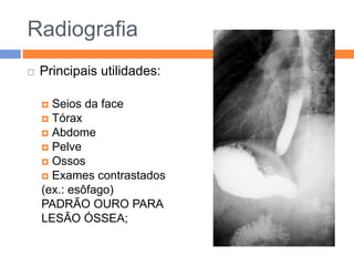 Radiografia
   Principais utilidades:

     Seios da face
     Tórax
     Abdome
     Pelve
     Ossos
     Exames contrastados
    (ex.: esôfago)
    PADRÃO OURO PARA
    LESÃO ÓSSEA;
 