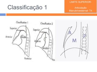 LIMITE SUPERIOR:

Classificação 1       Articulação
                  Manubrioesternal- T4
 