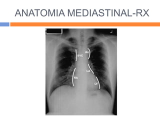 ANATOMIA MEDIASTINAL-RX
 