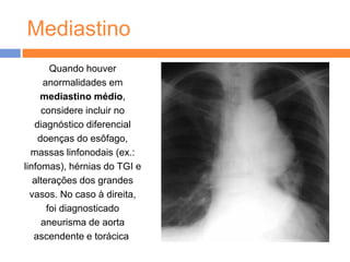 Mediastino
        Quando houver
      anormalidades em
     mediastino médio,
     considere incluir no
   diagnóstico diferencial
    doenças do esôfago,
  massas linfonodais (ex.:
linfomas), hérnias do TGI e
   alterações dos grandes
  vasos. No caso à direita,
       foi diagnosticado
     aneurisma de aorta
   ascendente e torácica.
 