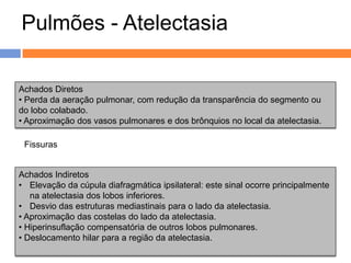 Pulmões - Atelectasia,

Achados Diretos
• Perda da aeração pulmonar, com redução da transparência do segmento ou
do lobo colabado.
• Aproximação dos vasos pulmonares e dos brônquios no local da atelectasia.

 Fissuras


Achados Indiretos
• Elevação da cúpula diafragmática ipsilateral: este sinal ocorre principalmente
   na atelectasia dos lobos inferiores.
• Desvio das estruturas mediastinais para o lado da atelectasia.
                                        .
• Aproximação das costelas do lado da atelectasia.
• Hiperinsuflação compensatória de outros lobos pulmonares.
• Deslocamento hilar para a região da atelectasia.
 