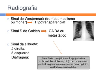Radiografia
   Sinal de Westermark (tromboembolismo
    pulmonar)     Hipotransparência!

   Sinal S de Golden            CA BA ou
                                 metastático

   Sinal da silhueta:
    à direita:
    à esquerda:
    Diafragma:              Sinal S de ouro (Golden S sign) – indica
                          colapso lobar (lobo sup.dir.) com uma massa
                         central, sugerindo um carcinoma broncogênico
                                     obstrutivo em um adulto.
 