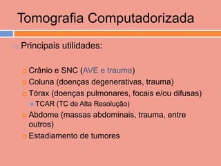 Tomografia Computadorizada
   Principais utilidades:

     Crânio e SNC (AVE e trauma)
     Coluna (doenças degenerativas, trauma)

     Tórax (doenças pulmonares, focais e/ou difusas)
       TCAR   (TC de Alta Resolução)
     Abdome    (massas abdominais, trauma, entre
      outros)
     Estadiamento de tumores
 