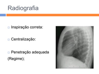 Radiografia


   Inspiração correta:


   Centralização:


   Penetração adequada
(Regime);
 