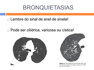 BRONQUIETASIAS
   Lembre do sinal de anel de sinete!

   Pode ser cilídrica, varicosa ou cística!
 