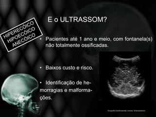 E o ULTRASSOM?

• Pacientes até 1 ano e meio, com fontanela(s)
  não totalmente ossificadas.



• Baixos custo e risco.

• Identificação de he-
morragias e malforma-
ções.
 