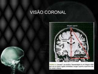 VISÃO CORONAL
 