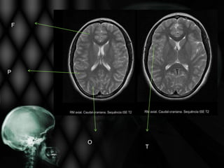 F




P




        O
            T
 