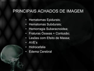 PRINCIPAIS ACHADOS DE IMAGEM
     •   Hematomas Epidurais;
     •   Hematomas Subdurais;
     •   Hemorragia Subaracnoidea;
     •   Fraturas Ósseas + Contusão;
     •   Lesões com Efeito de Massa;
     •   AVE’s
     •   Hidrocefalia
     •   Edema Cerebral
 