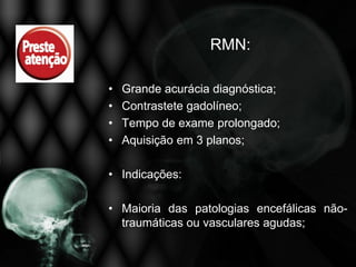 RMN:

•   Grande acurácia diagnóstica;
•   Contrastete gadolíneo;
•   Tempo de exame prolongado;
•   Aquisição em 3 planos;

• Indicações:

• Maioria das patologias encefálicas não-
  traumáticas ou vasculares agudas;
 