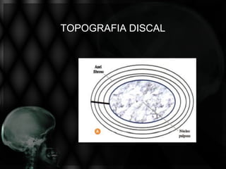 TOPOGRAFIA DISCAL
 