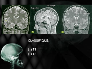 CLASSIFIQUE:

( ) T1
( ) T2
 