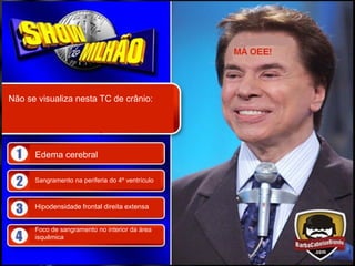 Não se visualiza nesta TC de crânio:




      Edema cerebral

      Sangramento na periferia do 4º ventrículo



      Hipodensidade frontal direita extensa


      Foco de sangramento no interior da área
      isquêmica
 