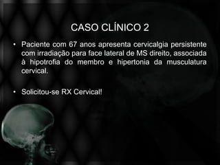 CASO CLÍNICO 2
• Paciente com 67 anos apresenta cervicalgia persistente
  com irradiação para face lateral de MS direito, associada
  à hipotrofia do membro e hipertonia da musculatura
  cervical.

• Solicitou-se RX Cervical!
 