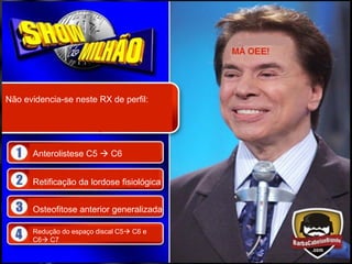 Não evidencia-se neste RX de perfil:




      Anterolistese C5  C6


      Retificação da lordose fisiológica


      Osteofitose anterior generalizada

      Redução do espaço discal C5 C6 e
      C6 C7
 