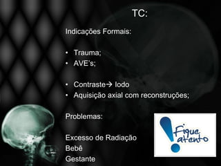 TC:
Indicações Formais:

• Trauma;
• AVE’s;

• Contraste Iodo
• Aquisição axial com reconstruções;

Problemas:

Excesso de Radiação
Bebê
Gestante
 