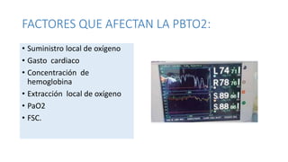 Pbto2 Monitor MONITORIAZACIÓN EN NEUROANESTESIOLOGÍA.pptx