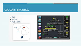 CVC COM FIBRA ÓTICA
 
