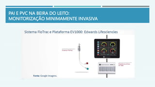 PAI E PVC NA BEIRA DO LEITO:
MONITORIZAÇÃO MINIMAMENTE INVASIVA
 
