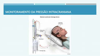 MONITORAMENTO DA PRESSÃO INTRACRANIANA
 