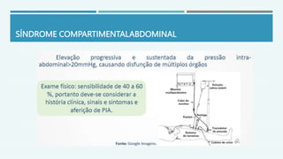 SÍNDROME COMPARTIMENTALABDOMINAL
 