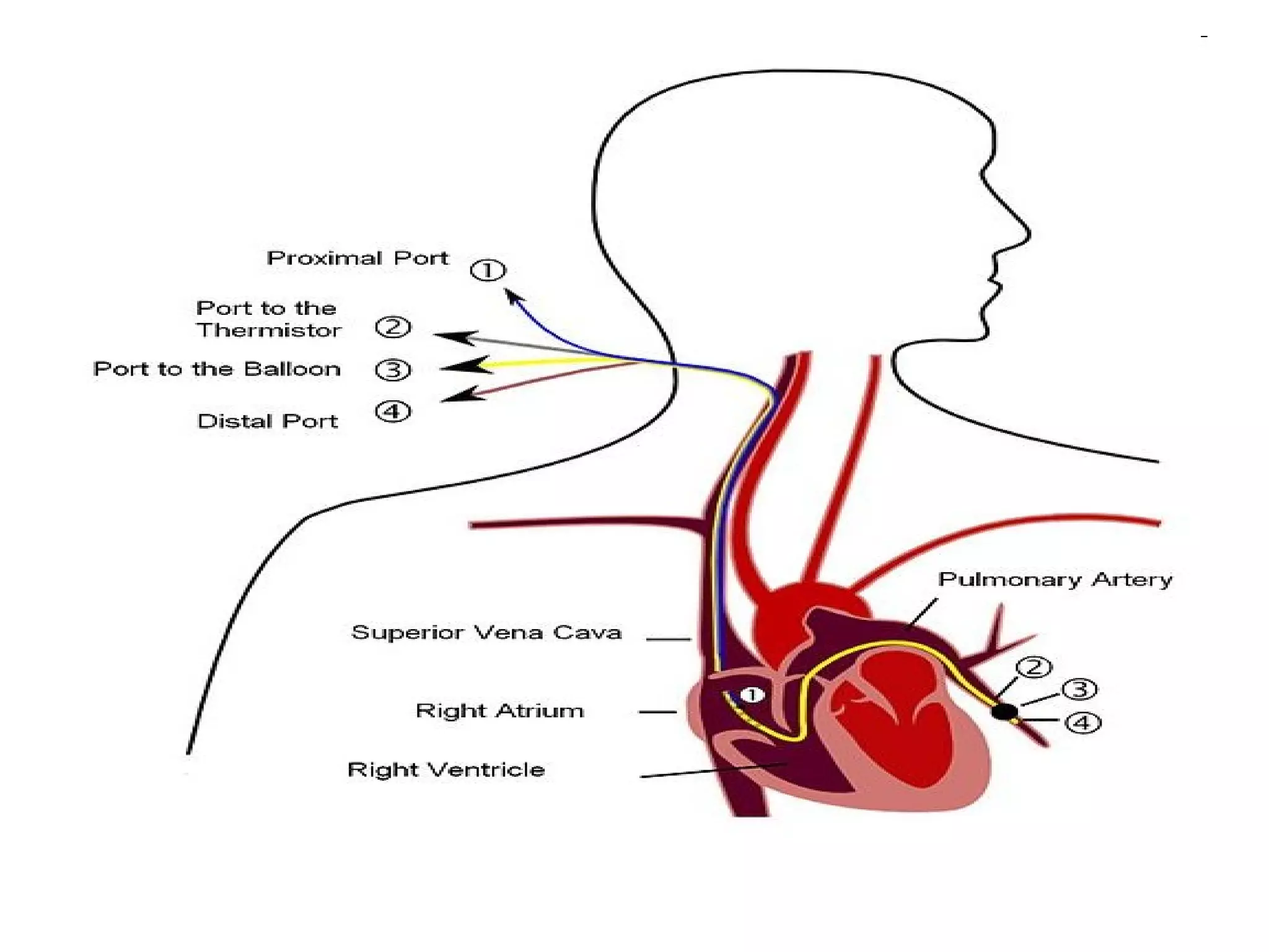 anaesthesia.Monitoring 2(dr.amr)