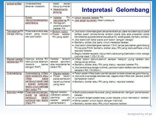 Intepretasi  Gelombang 