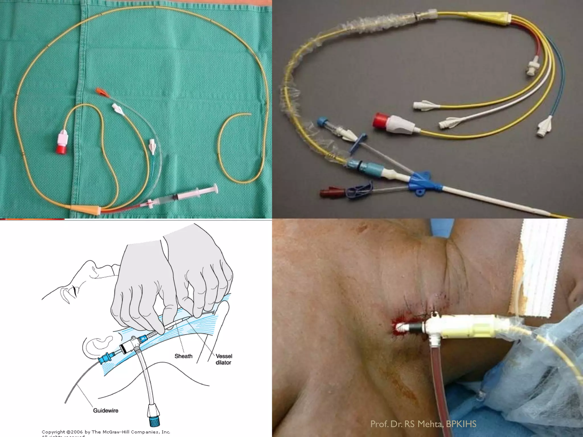 Prof.Dr. RS Mehta, BPKIHS
 