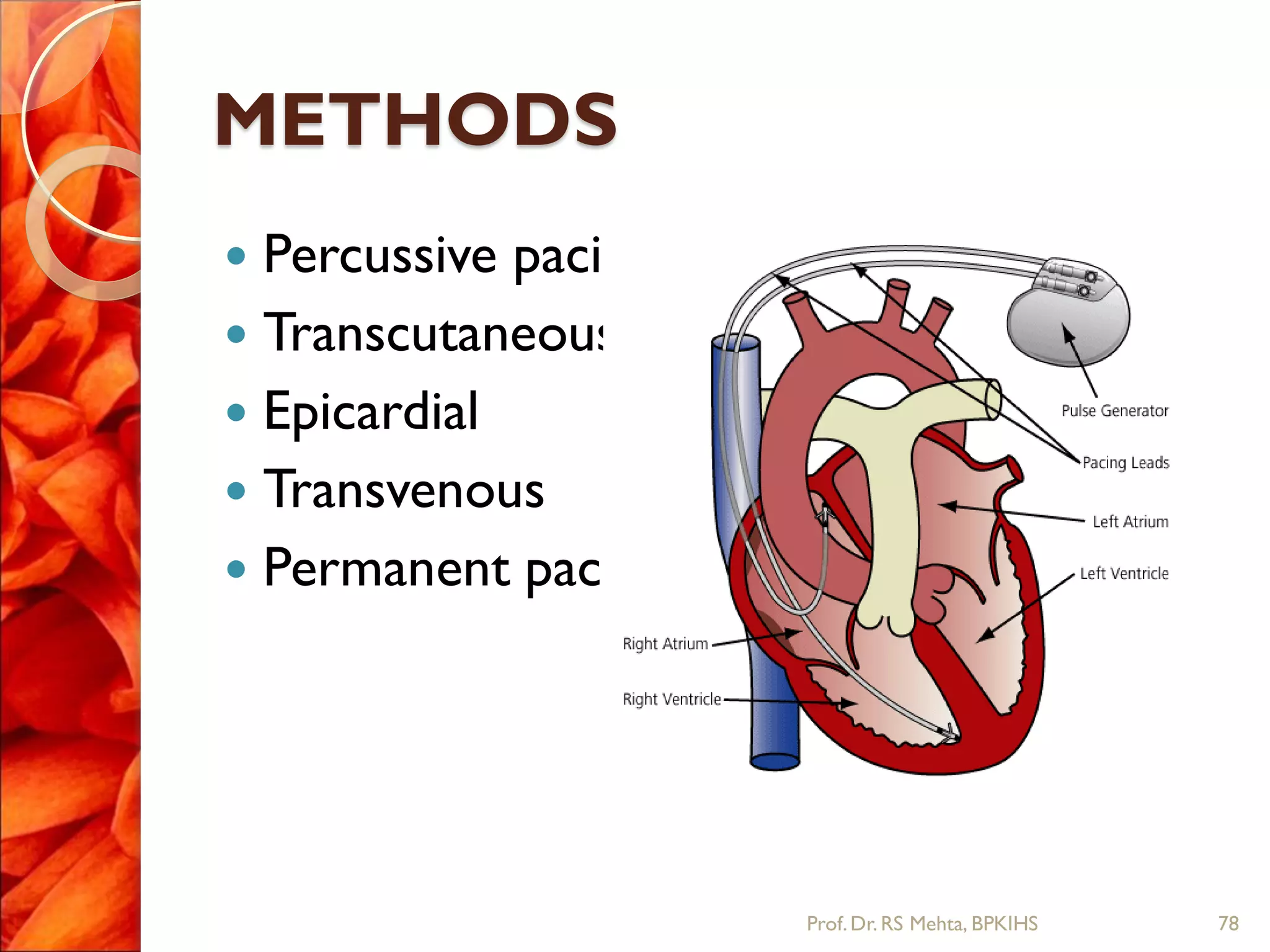 METHODS
 Percussive pacing
 Transcutaneous
 Epicardial
 Transvenous
 Permanent pacing
78Prof.Dr. RS Mehta, BPKIHS
 