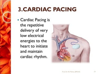3.CARDIAC PACING
 Cardiac Pacing is
the repetitive
delivery of very
low electrical
energies to the
heart to initiate
and maintain
cardiac rhythm.
77Prof.Dr. RS Mehta, BPKIHS
 