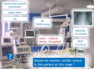 Pao2 Monitoring Which cardiac output monitoring? | PPTX