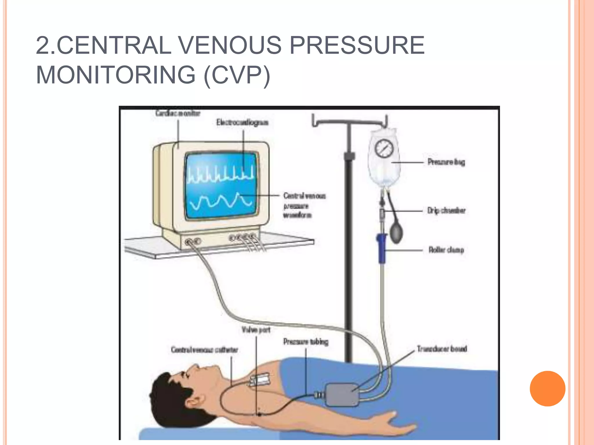 Monitoring in anaesthesia ro | PPTX