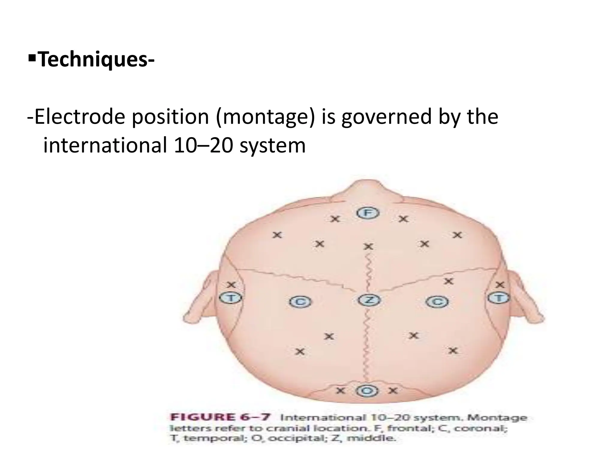 Techniques-
-Electrode position (montage) is governed by the
international 10–20 system
 