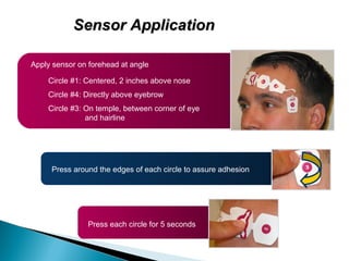 Sensor Application
Apply sensor on forehead at angle
Circle #1: Centered, 2 inches above nose
Circle #4: Directly above eyebrow
Circle #3: On temple, between corner of eye
and hairline

Press around the edges of each circle to assure adhesion

Press each circle for 5 seconds

 