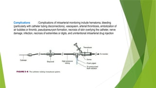 Complications : Complications of intraarterial monitoring include hematoma, bleeding
(particularly with catheter tubing disconnections), vasospasm, arterial thrombosis, embolization of
air bubbles or thrombi, pseudoaneurysm formation, necrosis of skin overlying the catheter, nerve
damage, infection, necrosis of extremities or digits, and unintentional intraarterial drug injection
 