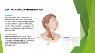 CENTRAL VENOUS CATHETERIZATION
Indications
Monitoring central venous pressure (CVP),
administration of fluid to treat hypovolemia
and shock, infusion of caustic drugs and total
parenteral nutrition, aspiration of air emboli,
insertion of transcutaneous pacing leads, and
gaining venous access in patients with poor
peripheral veins.
Contraindications
Relative contraindications include tumors,
clots, or tricuspid valve vegetations that could
be dislodged or embolized during cannulation.
Other contraindications relate to the
cannulation site.
 
