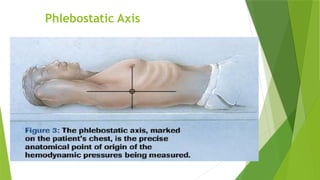 Phlebostatic Axis
 