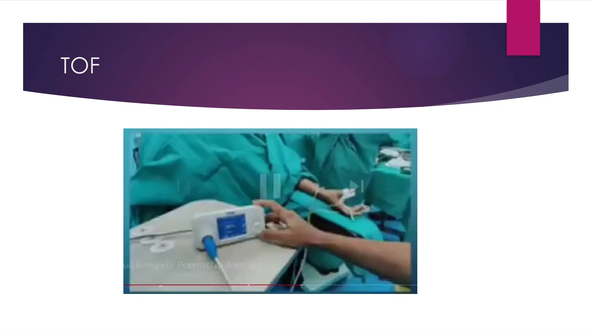 TOF
 