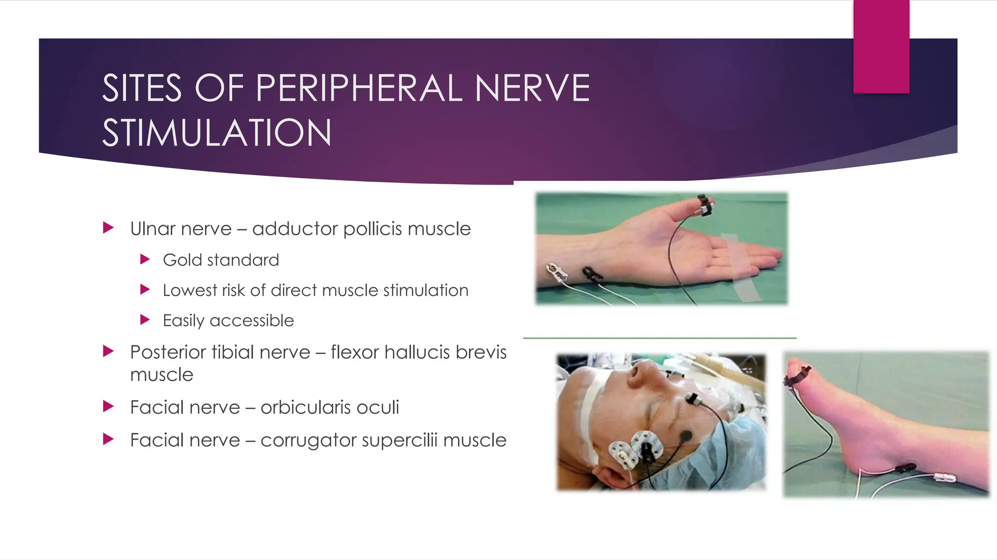 SITES OF PERIPHERAL NERVE
STIMULATION
 Ulnar nerve – adductor pollicis muscle
 Gold standard
 Lowest risk of direct muscle stimulation
 Easily accessible
 Posterior tibial nerve – flexor hallucis brevis
muscle
 Facial nerve – orbicularis oculi
 Facial nerve – corrugator supercilii muscle
 