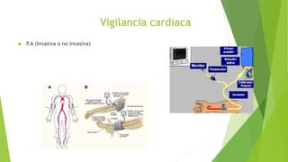 Vigilancia cardiaca
 P.A (Invasiva o no Invasiva)
 